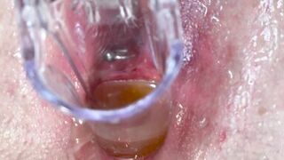 He pee into my pussy by speculum and I squirt too