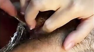 Dirty Slut Wife Anal. Development Hairy Ass Hole. Fisting & Double Penetration. - 4 image